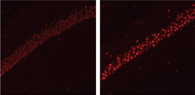 HDAC2 is Elevated in Alzheimer's Disease