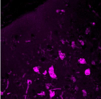 Combination Treatment in Mice Shows Promise for Fatal Neurological Disorder in Kids