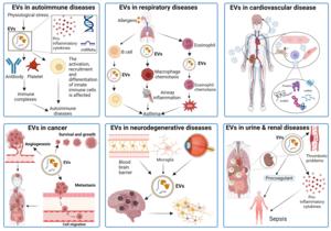 Extracellular vesicles shown in disease states