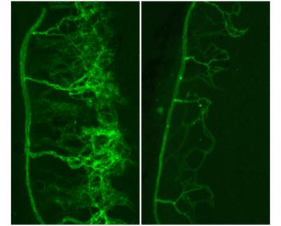 Blood Vessel Formation with and without Galectin-3