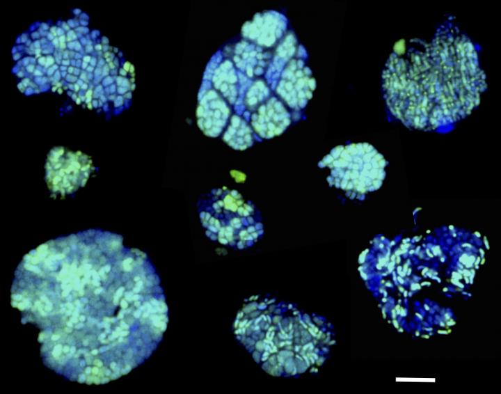 Archae and Bacteria Consortia Analyzed for the First Time