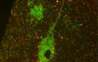 B Cells and Regulatory T Cells in the Thymus