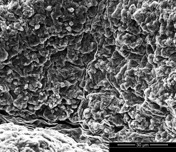 Extracellular Matrix