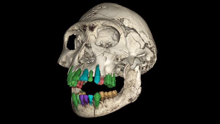 3D reconstruction of the fossil skull of the sub-adult early Homo from the Dmanisi site in Georgia.