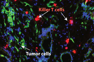 Novel treatment makes pancreatic cancer susceptible to immunotherapy, mouse study shows