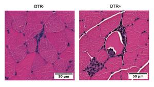 Immune cells mobilized during exercise counter exercise-induced inflammation