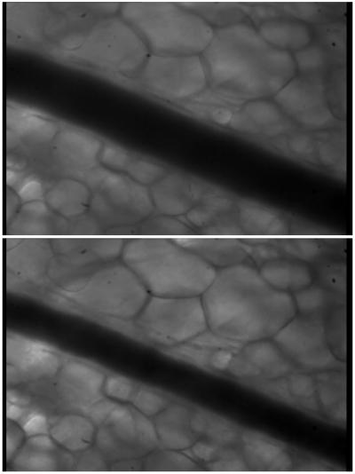 Controlling Blood Flow to Tissues