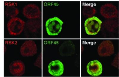 Microscopic Image of KS Cells