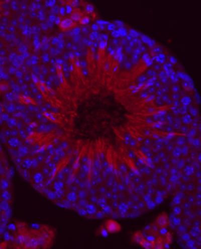 Taste Proteins in Mature Sperm