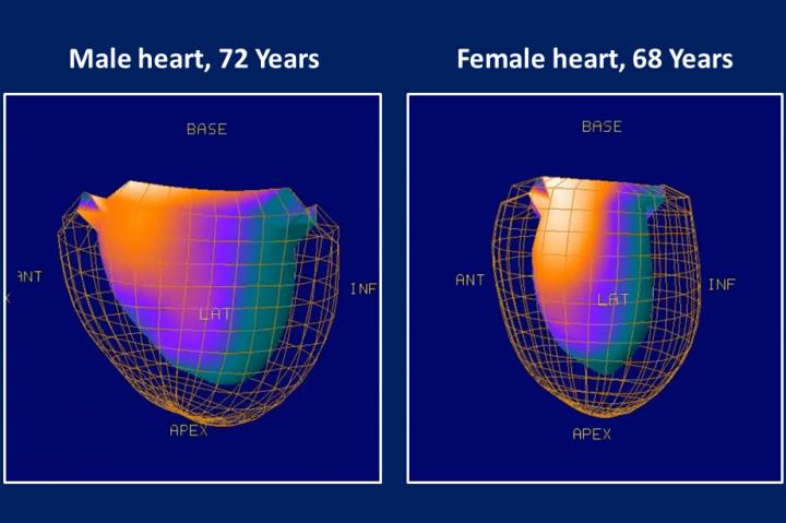 Size and Function of Aged Male and Female Heart