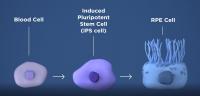 How iPSC-Based Therapy Works