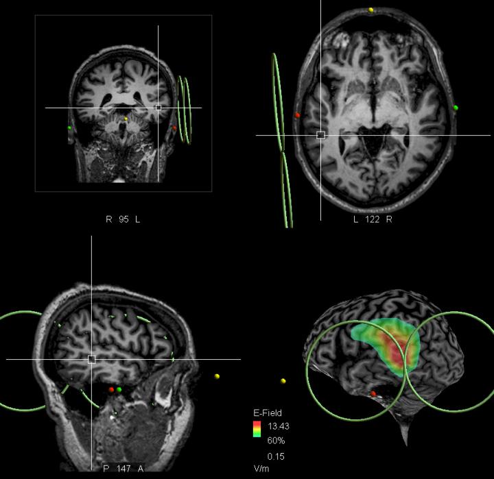 Patient's Real-Time MRI