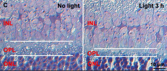 Strategy Combines and Repurposes Drugs for Eye Disease (1 of 2)