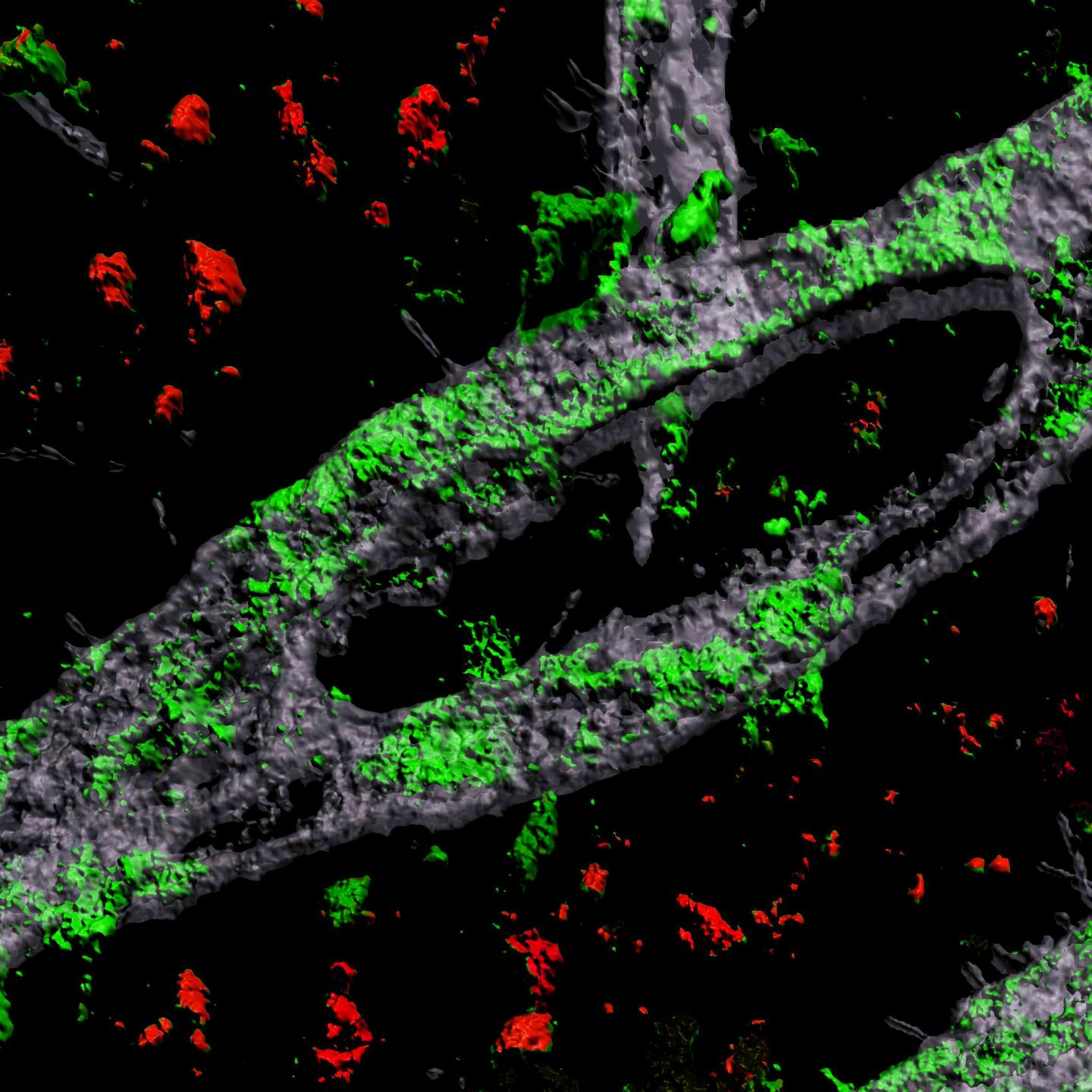 Amyloid Accumulation