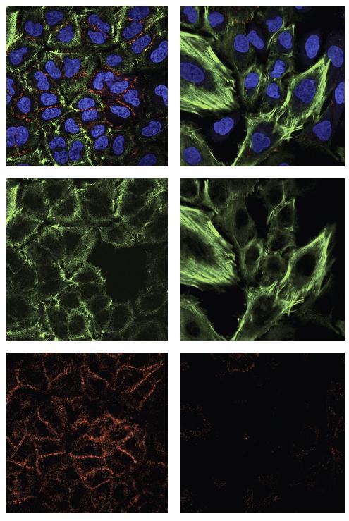 Cells Pushed Toward Metastasis
