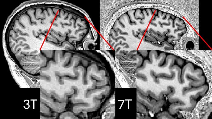 Comparison of 3T and 7T MRI scans