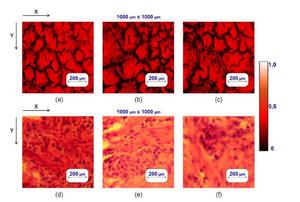 Microscopic and histological images of blood smears and prostate tissue biopsies