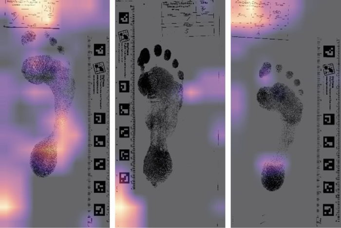 2D footprints can be sexed with up to 90 percent accuracy by machine learning algorithm