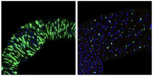 Balance between stem cell exhaustion and proliferation