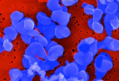 M. burtonii Cells Isolated from Ace Lake