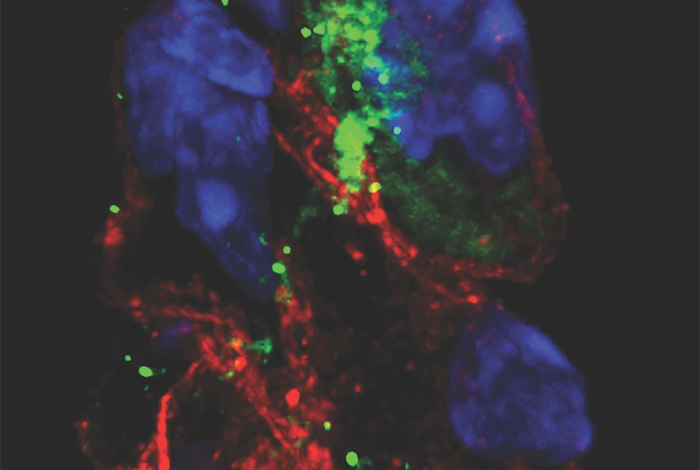 Colorarea proteinei Spike SARS-CoV-2 în celulele stimulatoare cardiace ale hamsterilor infectați cu SARS-CoV-2.