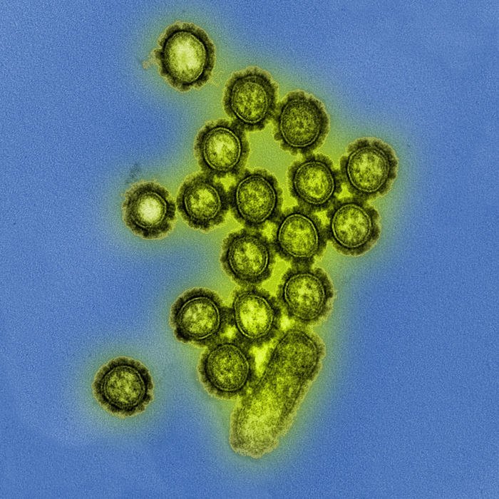 influenza virus particles