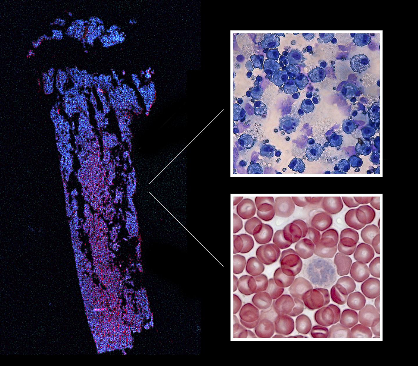 The Hematopoietic System