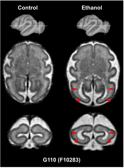 Figure 1b