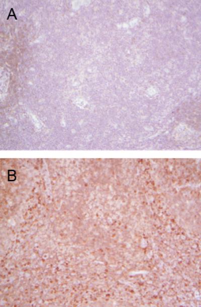 Unless Activated, T-cells Don't Express Protein S