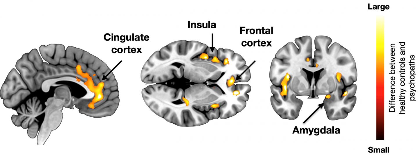 Brain self-regulation in criminal psychopaths