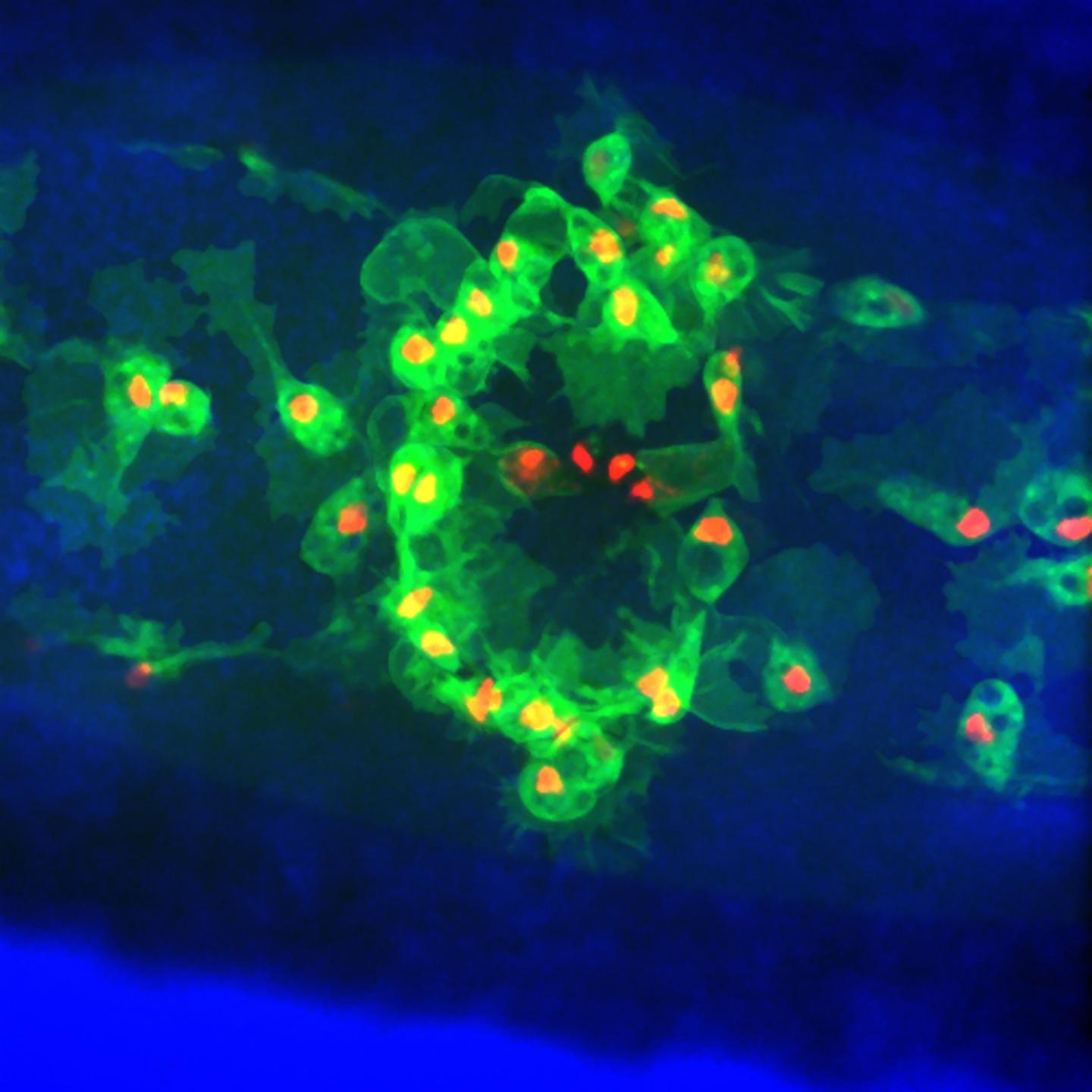 Macrophages at Wound