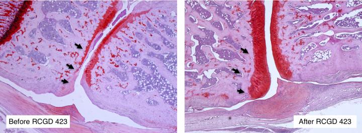 Cartilage Before and After RCGD 423