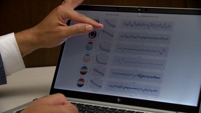 A computer screen shows results from an electroencephalogram, or EEG test