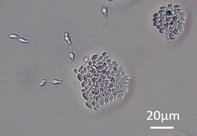 Antarctic Yeast <i>Mrakia blollopis</i> SK-4