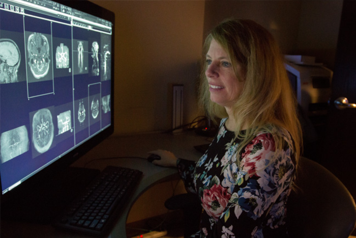 Dr. Roberts looks at brain scans