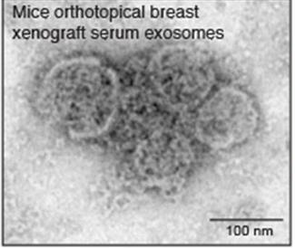 Exosomes