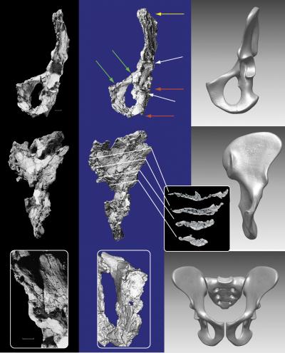 Before 'Lucy,' There Was 'Ardi:' First Major Analysis of One of Earliest Known Hominids (2 of 5)