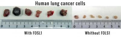 Human Lung Cancer Cells with and without FOSL1