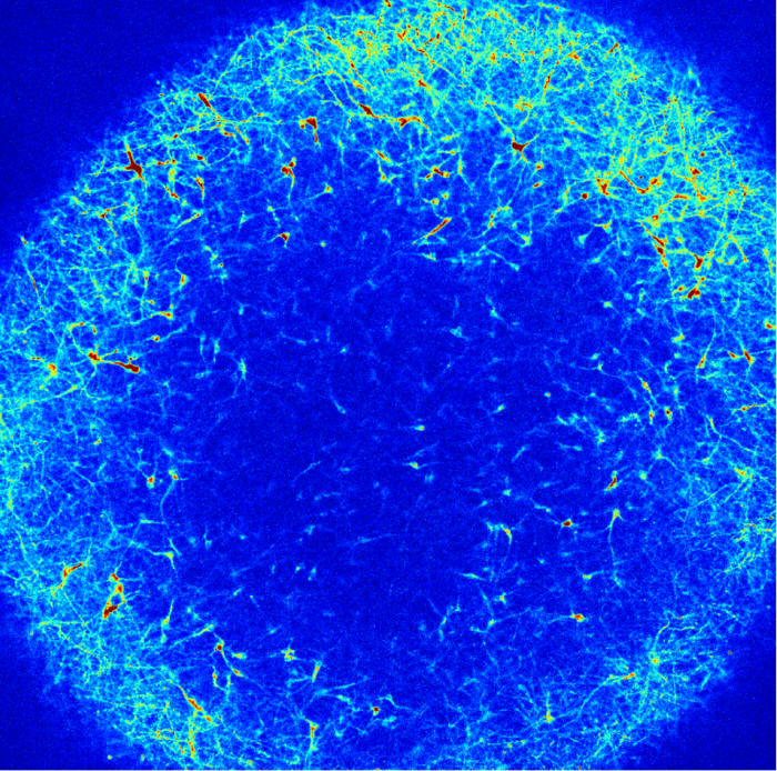 Brain organoid showing individual neurons firing