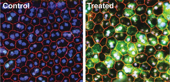 Base editing restores vision