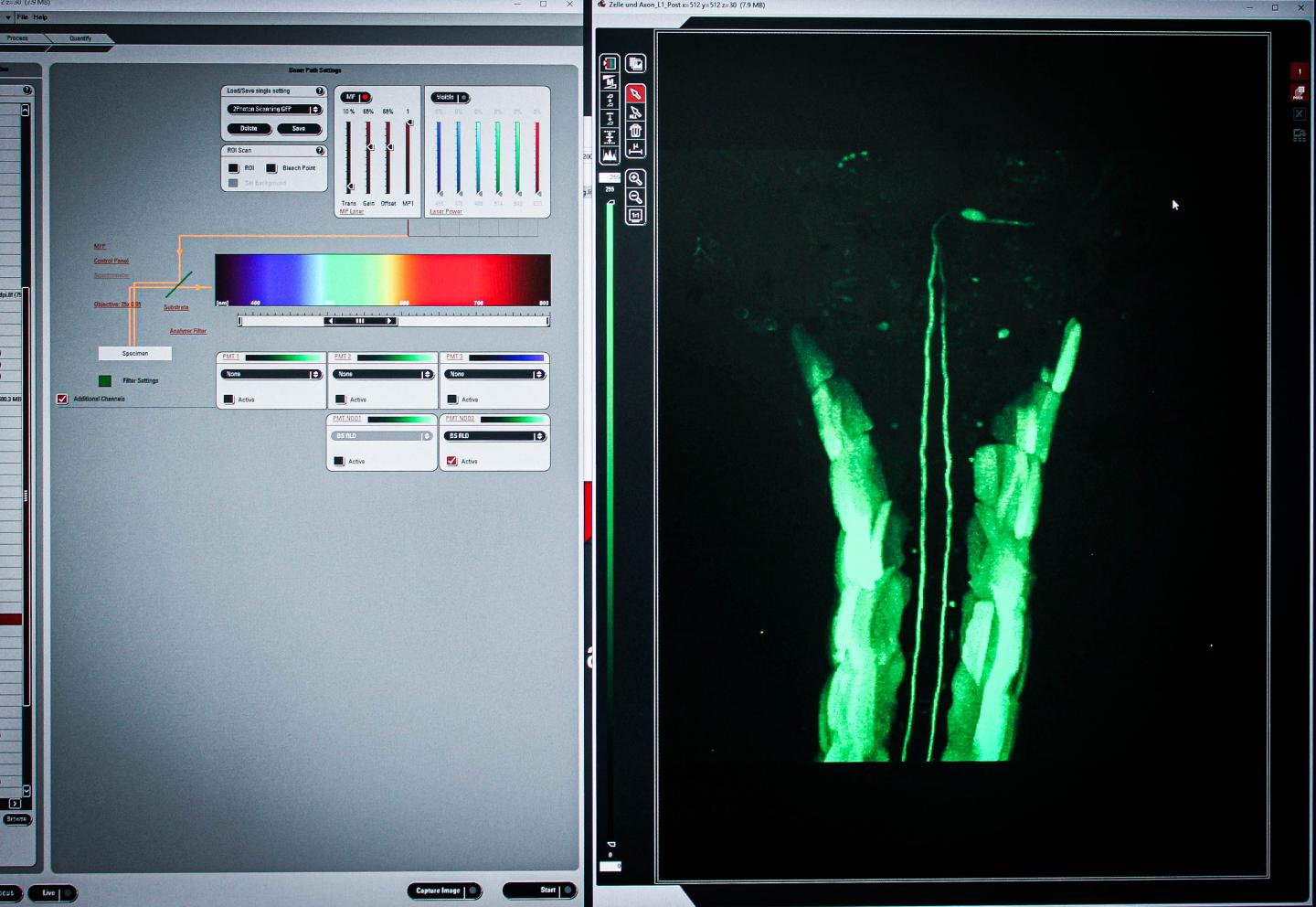 Observing Nerve Cells