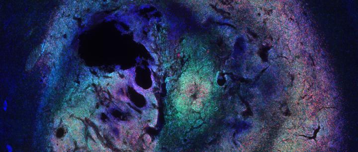 Cross-Section of Murine Braine Tumor