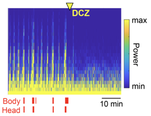 Chemogenetic attenuation of cortical seizures.