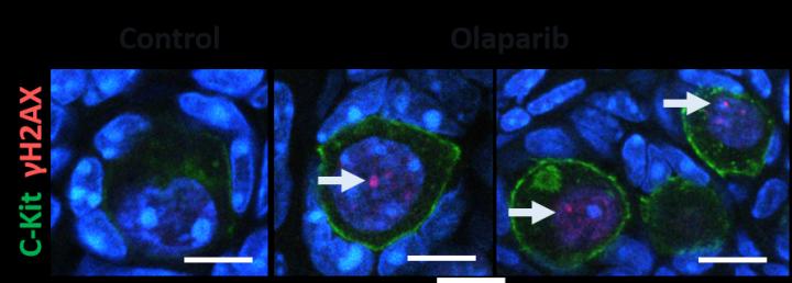 Breast Cancer Drug, Olaparib, Depletes Store of Immature Eggs in Mouse Ovaries