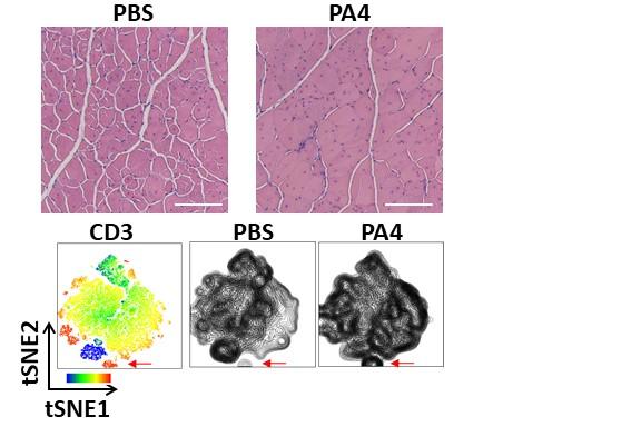 Nanoparticle-based cytokine therapy for Duchenne Muscular Dystrophy