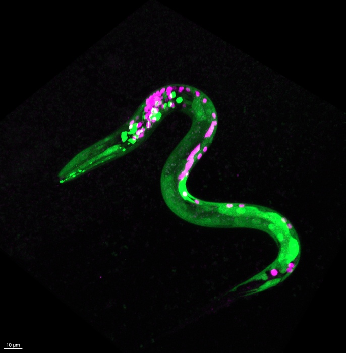 Image of worm that is genetically engineered so that certain neurons and muscles are fluorescent.