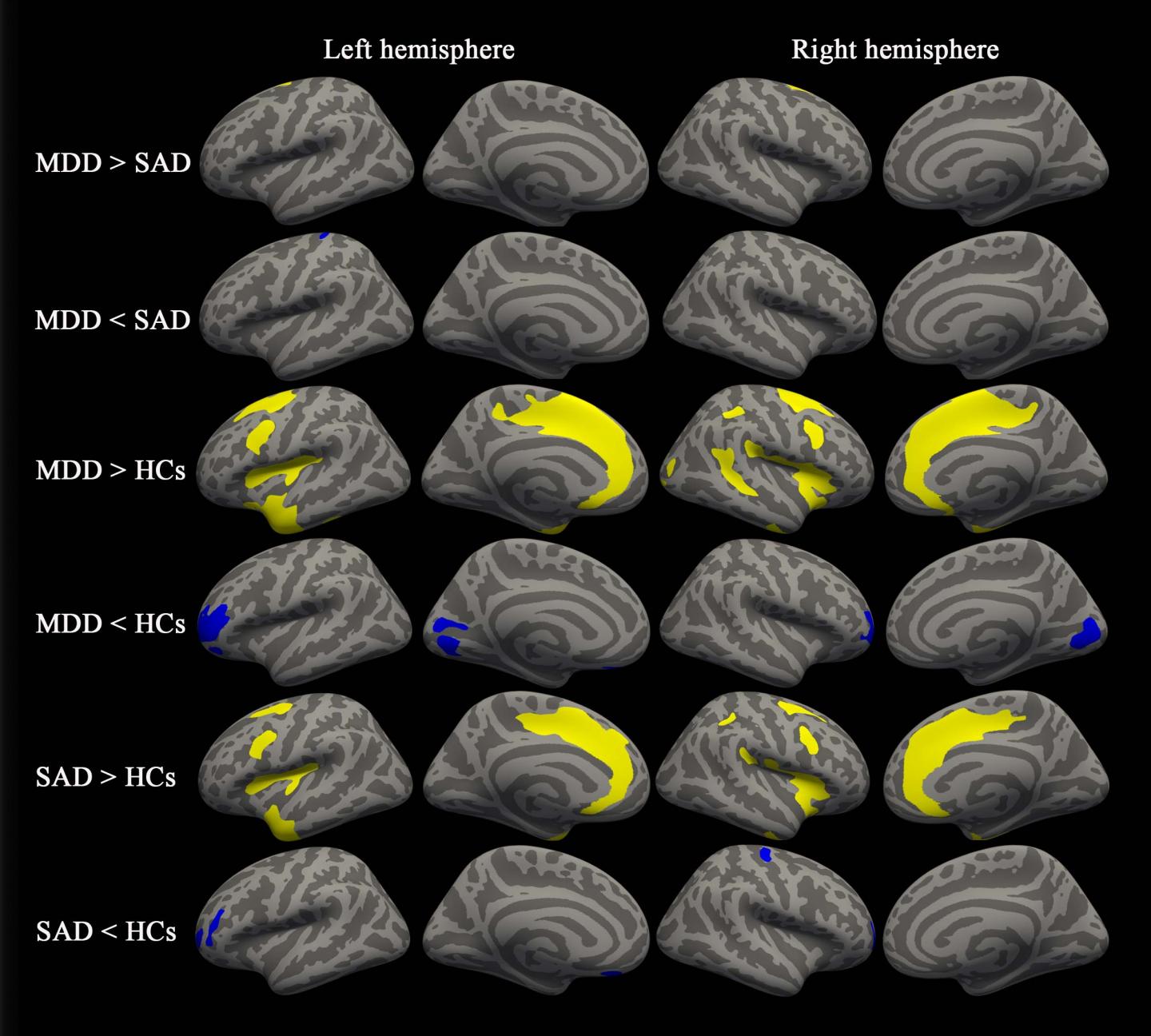 Between-Group Results for Cortical Thickness