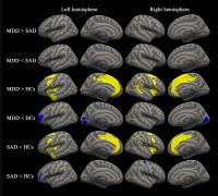Between-Group Results for Cortical Thickness