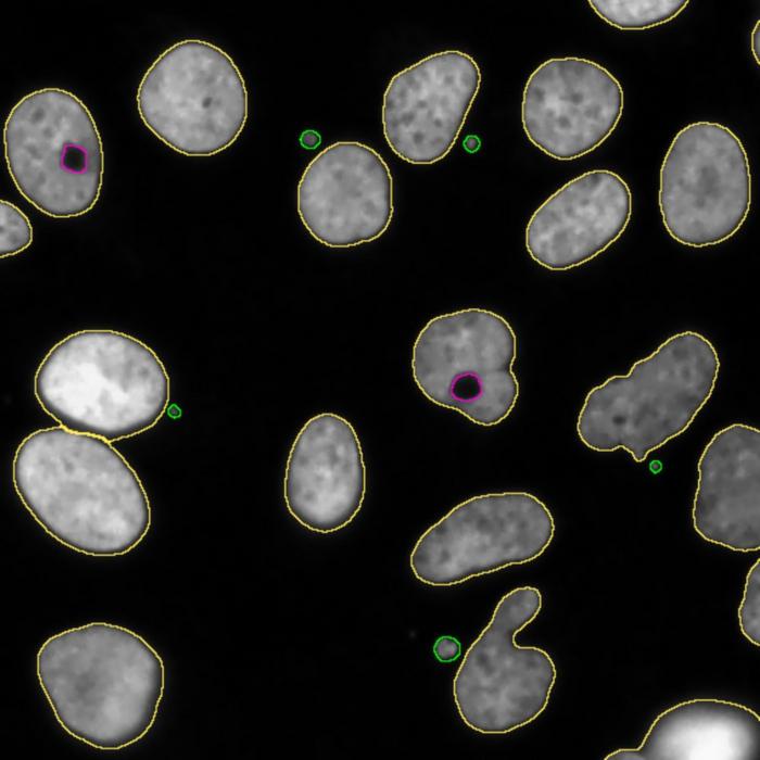 New bioinformatics tool to identify chromosomal alterations in tumour cells