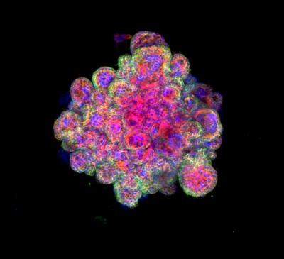 Trophoblast Organoid